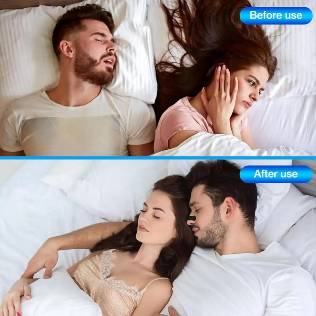 Breathing Support Nasal Strips for Sleep & Sports Zippmart